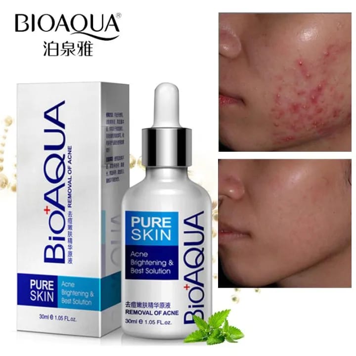 Bioaqua Anti-Acne Serum Removal Of Acne Essence Liquid 30ML