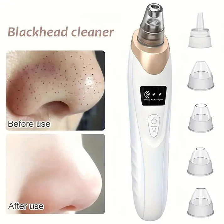 5-In-1 Rechargeable Suction Acne and Blackhead Remover for Men and Women